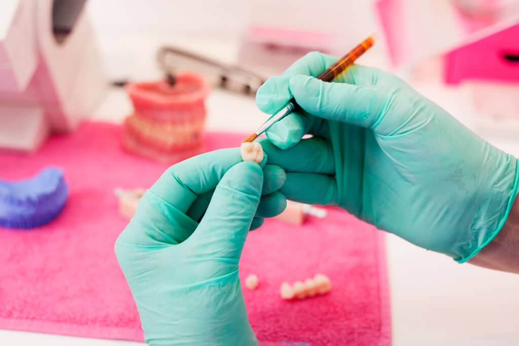 What Are Same-Day Crowns and How Do They Work?