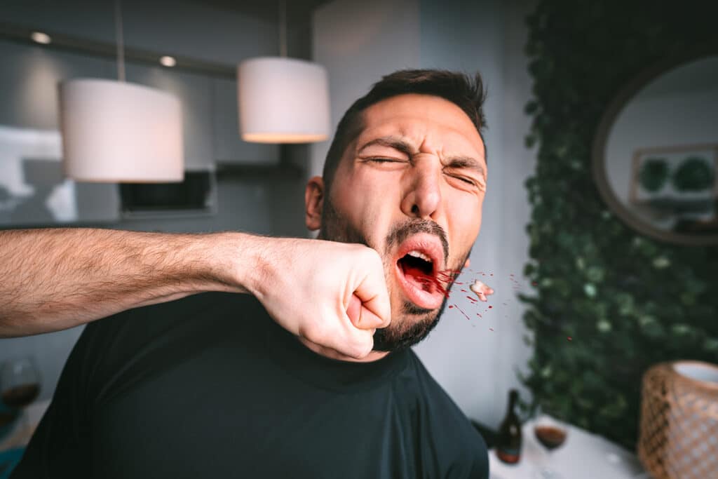 What to Do If You Knock Out a Tooth in Merrimac: A Step-by-Step Guide